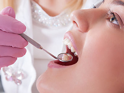 Raider General Dentistry | E4D, Implant Restorations and Teeth Whitening